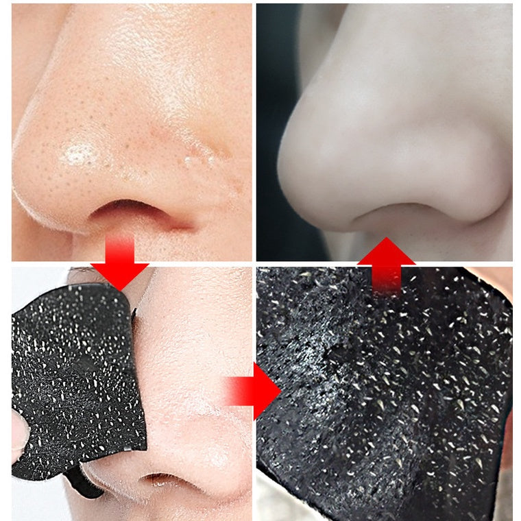 Remove Blackheads and Acne Nasal Membrane Nose Patch Blackhead Nasal Remover, Nose Strips Safe for Home